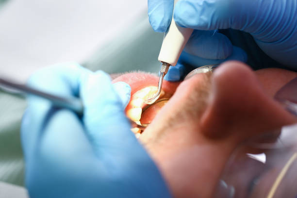 Best Emergency Dental Surgery in Weimar, TX