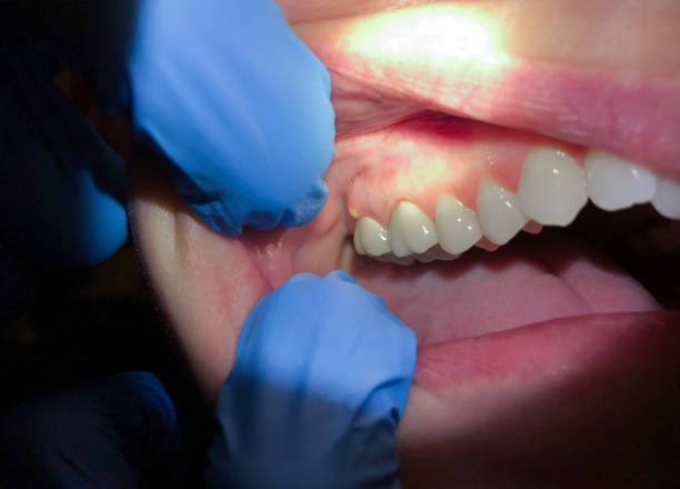 Best Emergency Dental Care for Trauma or Injury in Weimar, TX